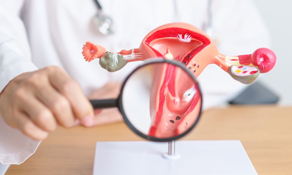 Cervical Cancer